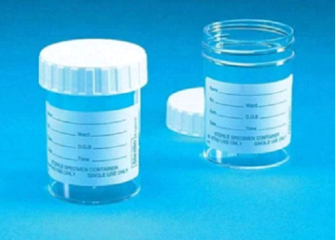 Sterile Urine Sample Bottle